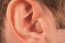 In-the-canal Hearing Aid