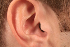 Invisible-in-canal Hearing Aid